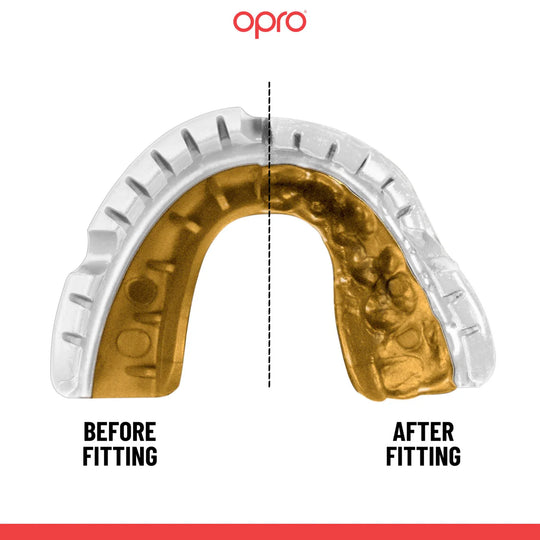 OPRO Gold Level  Mouthguard for Braces - White/Gold