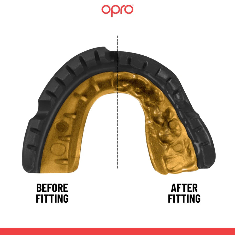 OPRO Gold Level  Mouthguard for Braces - Black/Gold
